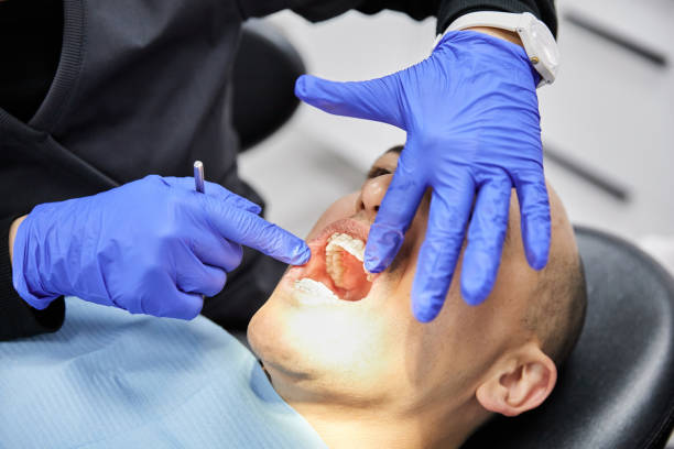 Best Emergency Dental Care for Broken or Chipped Teeth in Fife, WA